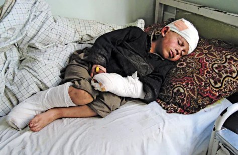 Injured Afghan boy